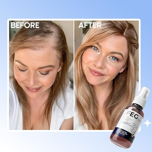 FEG Plus Hair Regrowth Spray (Original Formula)